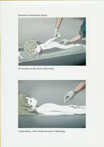 Page 5 of Nishiogikubo Shoujo Satsugai Jiken Shihou Kaibou Kiroku | Nishi-Ogikubo Girl Murder Case Judicial Autopsy Report - preview thumbnail