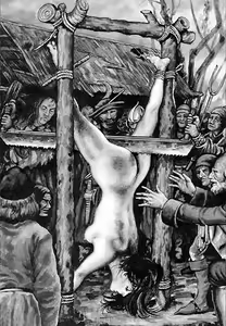 Page 198 of Dismemberment of the body - preview thumbnail
