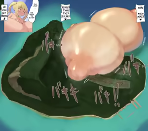 Page 379 of breast expansion - preview thumbnail